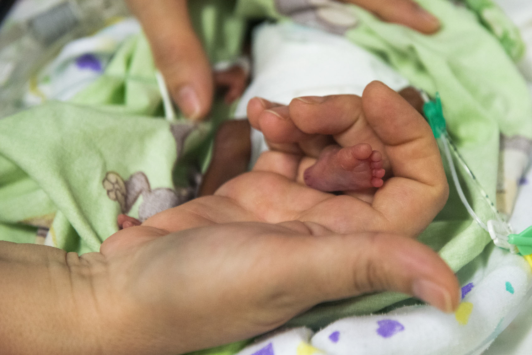 prematurita prematurita