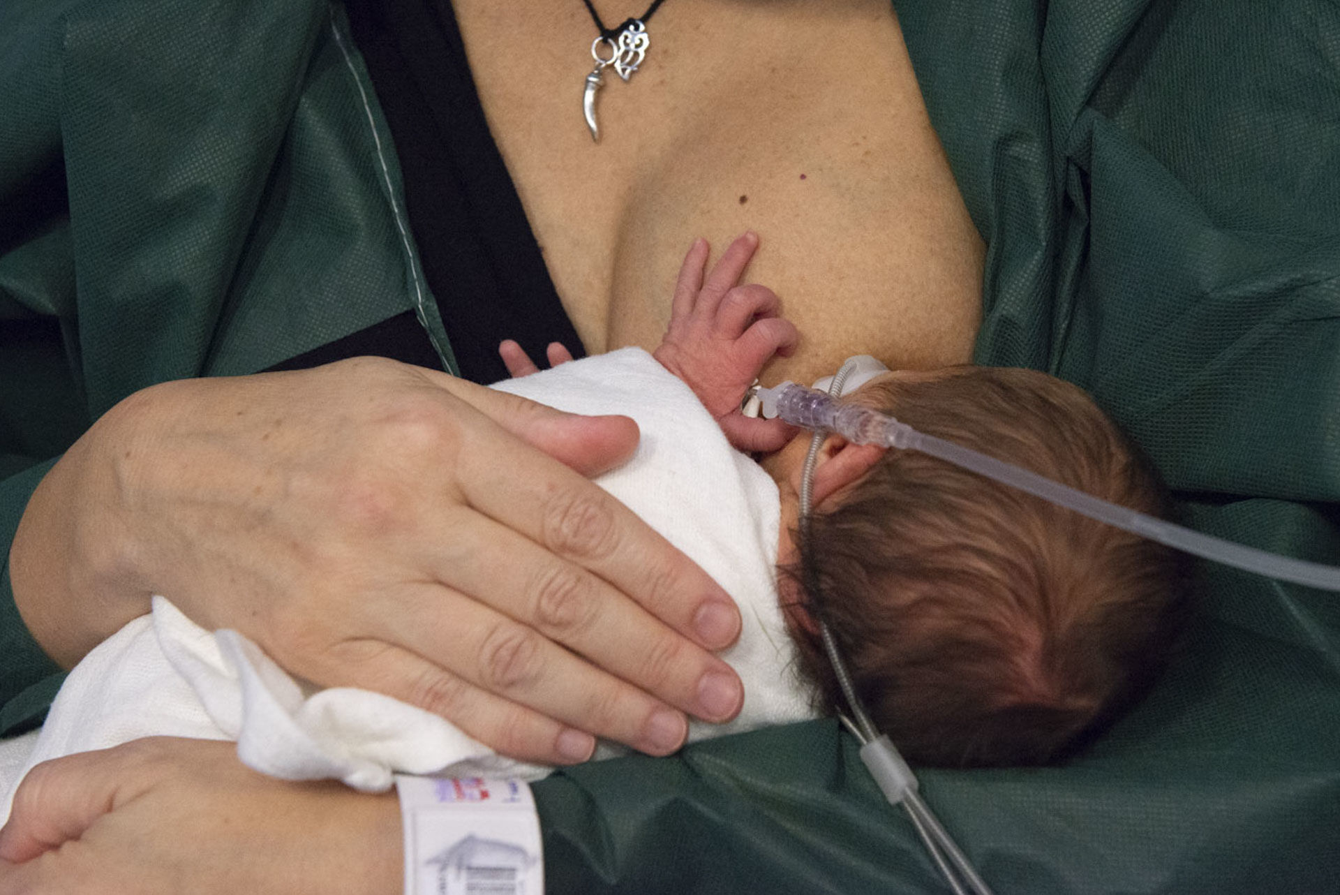 prematurita2